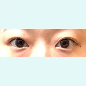 口コミ