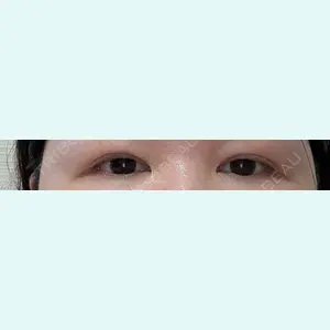 口コミ
