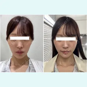 口コミ