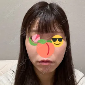 口コミ