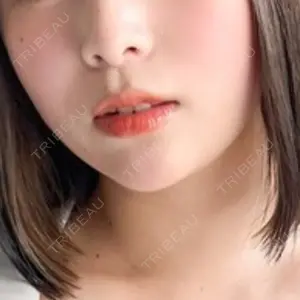 口コミ