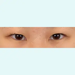 口コミ