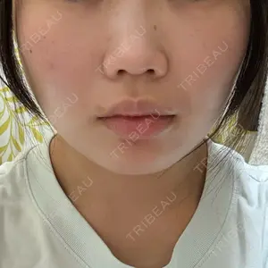 口コミ