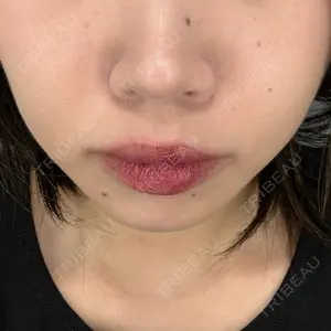 口コミ