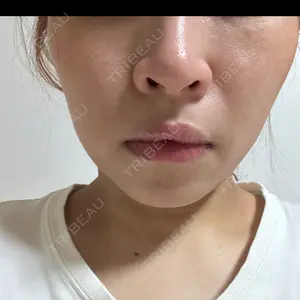 口コミ