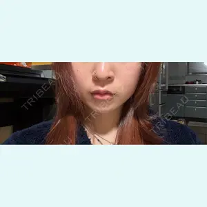 口コミ