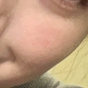 口コミ