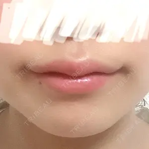 口コミ