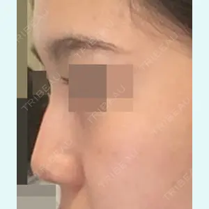 TL美容整形外科 顔面輪郭・目・鼻センターのキム・ジミョン医師口コミ