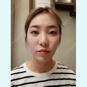 DA美容外科のLEE SANG WOO医師口コミ