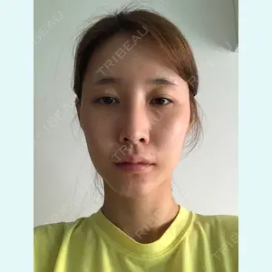 DA美容外科のLEE DONG CHAN医師口コミ