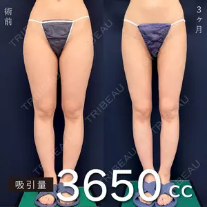 吉原 伯医師の症例