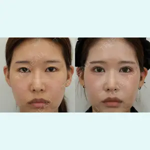 ソン・イクヒョン医師の症例