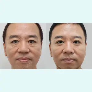 ソン・イクヒョン医師の症例
