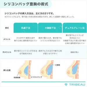 豊胸（脂肪注入）の解説画像6