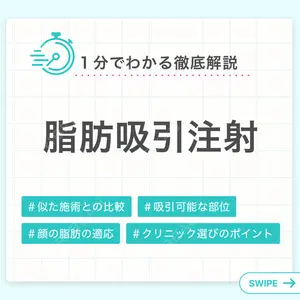 脂肪吸引注射（顔）の解説画像1