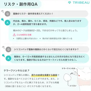 豊胸（脂肪注入）の解説画像8