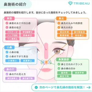 鼻孔縁下降の解説画像3