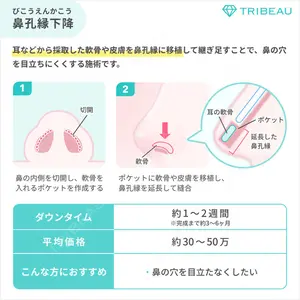 鼻孔縁下降の解説画像6