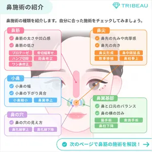 隆鼻術の解説画像3