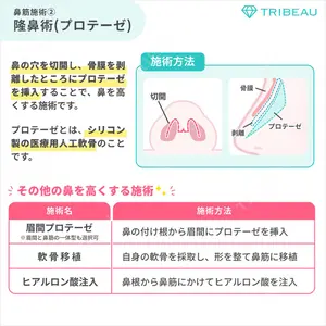 隆鼻術の解説画像6