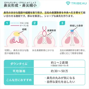 鼻中隔延長（非切開）の解説画像4