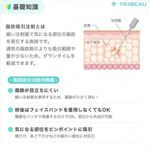 脂肪吸引注射（顔）の解説画像2