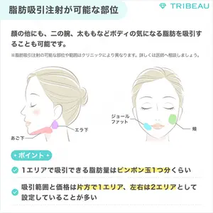 脂肪吸引注射（顔）の解説画像4