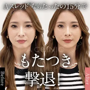A CLINIC（エークリニック） 仙台院 中村 光宏医師の症例