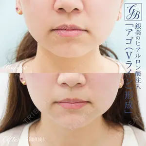銀座美容外科クリニック 銀座院の症例