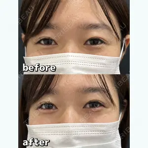 HAAB BEAUTY CLINIC 横浜院 小平 佳典医師の症例