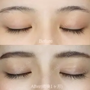 ハナビューティークリニック 厚田 幸子医師の症例