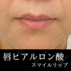 ルラ美容クリニック 渋谷本院 小松 正樹医師の症例