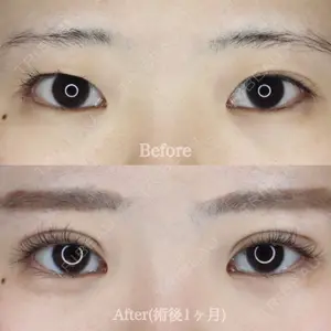 ハナビューティークリニック 厚田 幸子医師の症例