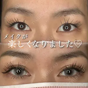 ルラ美容クリニック 神戸院 小海 元医師の症例