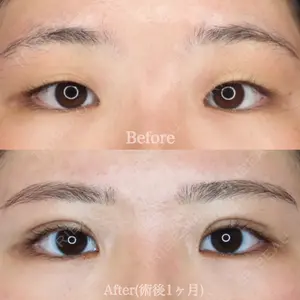 ハナビューティークリニック 厚田 幸子医師の症例