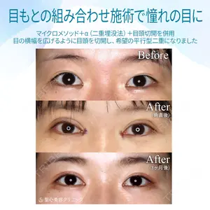 聖心美容クリニック 大阪院 大井 弘一医師の症例