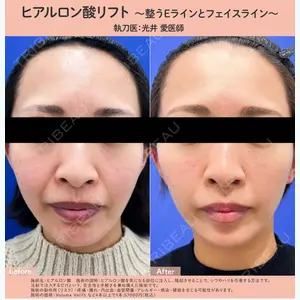 湘南美容クリニック 博多院 光井 愛医師の症例