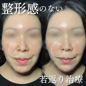 ルラ美容クリニック 神戸院 小海 元医師の症例