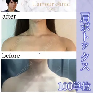 L‘amour clinic Tokyo【ラムールクリニック東京】 片岡 紘士医師の症例