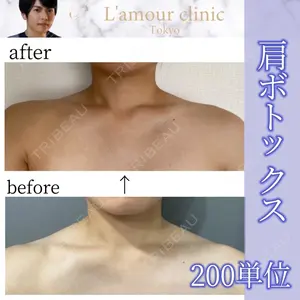 L‘amour clinic Tokyo【ラムールクリニック東京】の症例