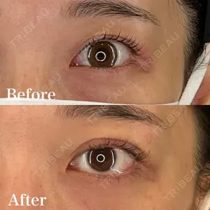 HAAB BEAUTY CLINIC 横浜院 小平 佳典医師の症例