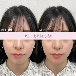 ルラ美容クリニック 東京駅前院 山本 泰輔医師の症例