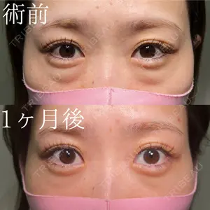 HAAB×DREAM BEAUTY CLINIC 大阪梅田院 鈴木 馨斗医師の症例