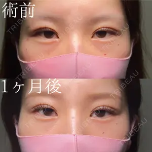 HAAB×DREAM BEAUTY CLINIC 大阪梅田院 鈴木 馨斗医師の症例