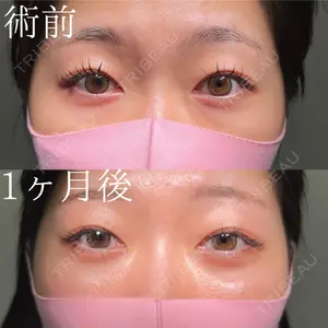 HAAB×DREAM BEAUTY CLINIC 大阪梅田院 鈴木 馨斗医師の症例