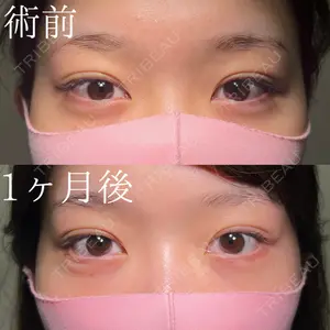 HAAB×DREAM BEAUTY CLINIC 大阪梅田院 鈴木 馨斗医師の症例