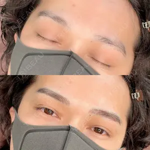 LEAGRANT CLINIC 中目黒 谷上 奈緒子医師の症例