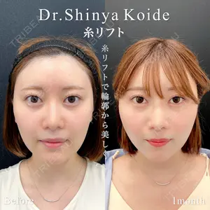 東京シンデレラ美容外科 池袋院 小出 真哉医師の症例