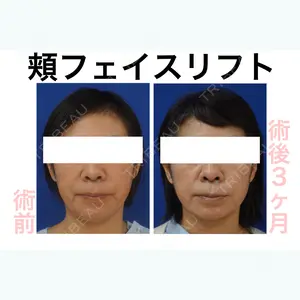 リッツ美容外科 大阪院の症例